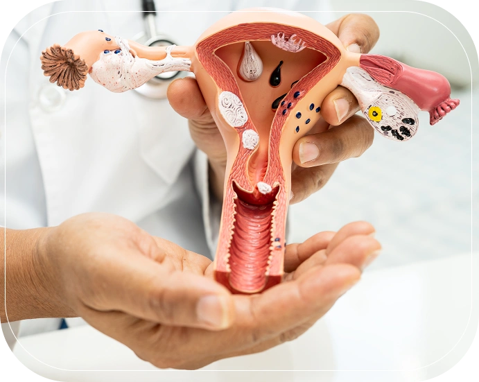 Causes of Endometriosis