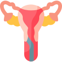 Endometriosis