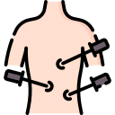 Laparoscopy for direct tube examination