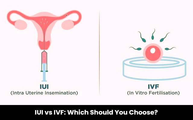 IUI vs IVF: Which Should You Choose?